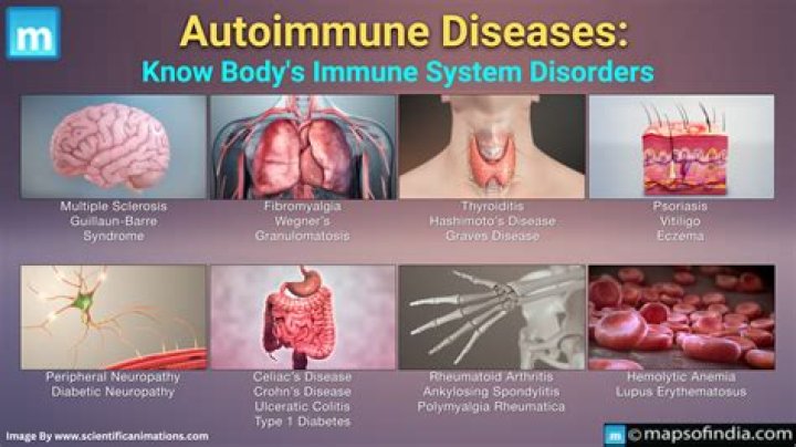 Do endocrinologist treat autoimmune diseases?