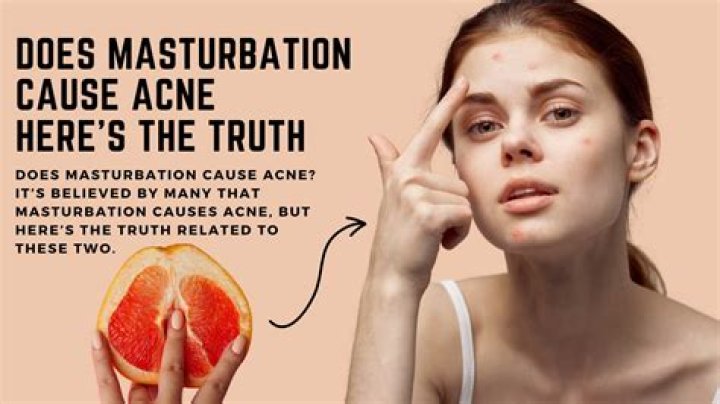 Do fruits cause acne?