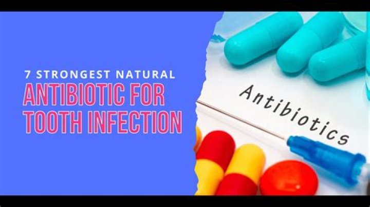 Do I need antibiotics before tooth extraction?
