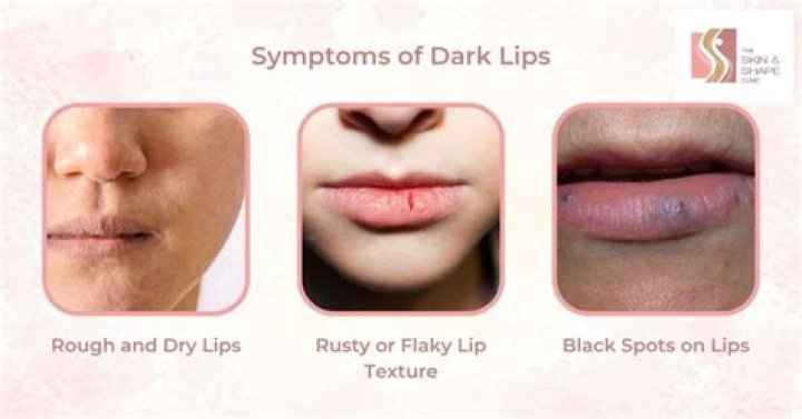 Do lip scrubs damage lips?