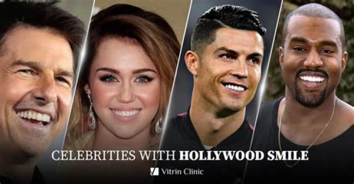 Do most celebs have veneers?