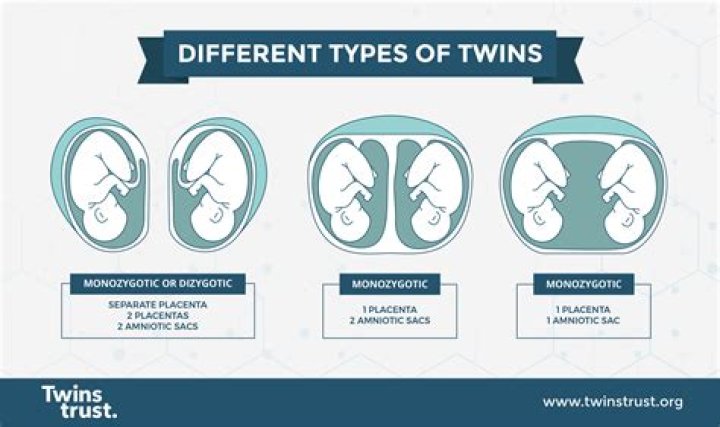 Do Wanda's twins exist?