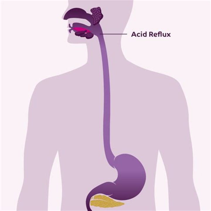 Do worms cause acid reflux?