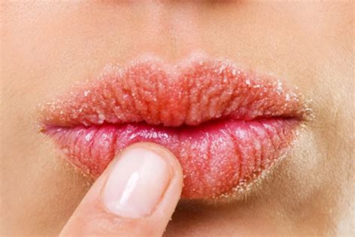 Do worms have lips?
