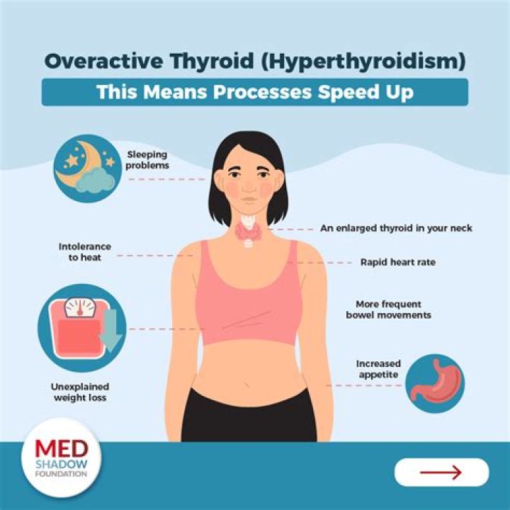 Do you sweat with hypothyroidism?