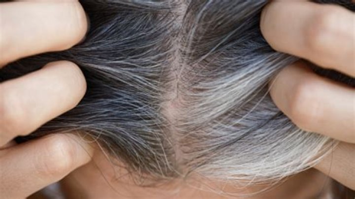 Does castor oil get rid of GREY hair?