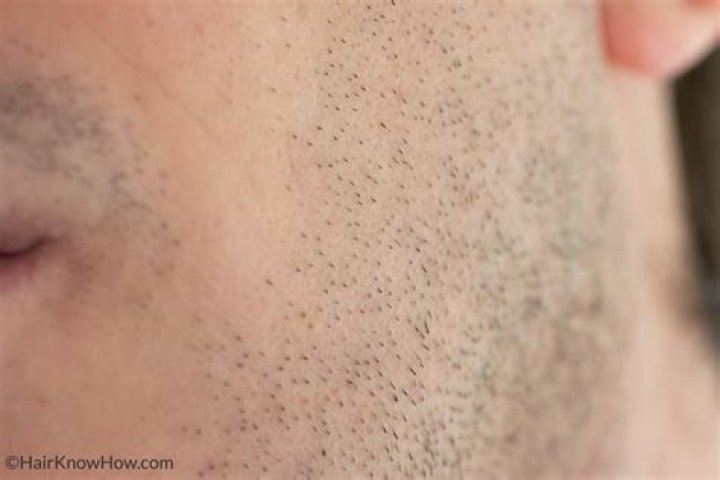 Does eucalyptus help grow facial hair?