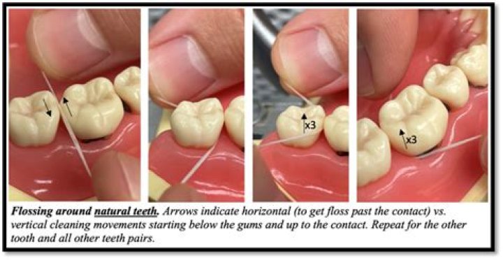 Does flossing strengthen gums?