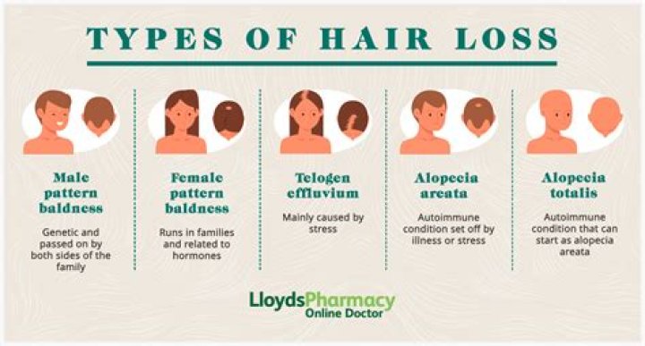 Does ginger cause hair loss?