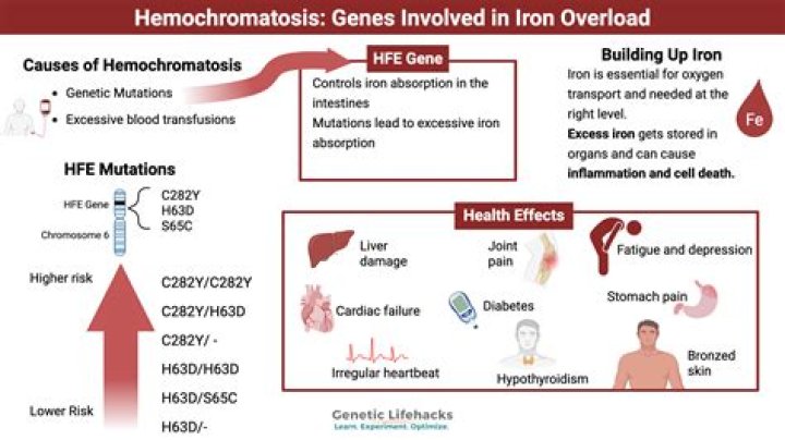 Does giving blood help hemochromatosis?