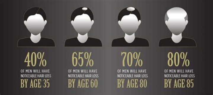 Does hair naturally thin as you age?