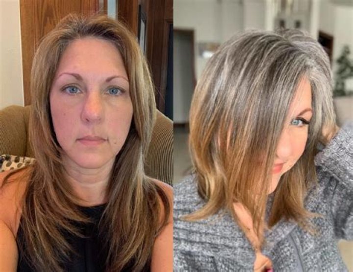 Does hair stay gray after chemo?
