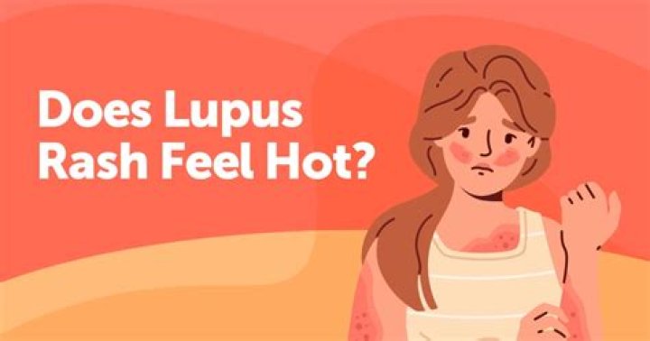 Does lupus cause burning skin?