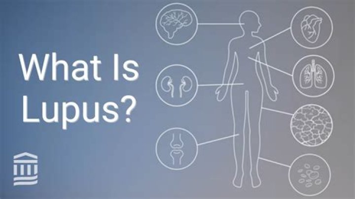 Does lupus cause sinus problems?