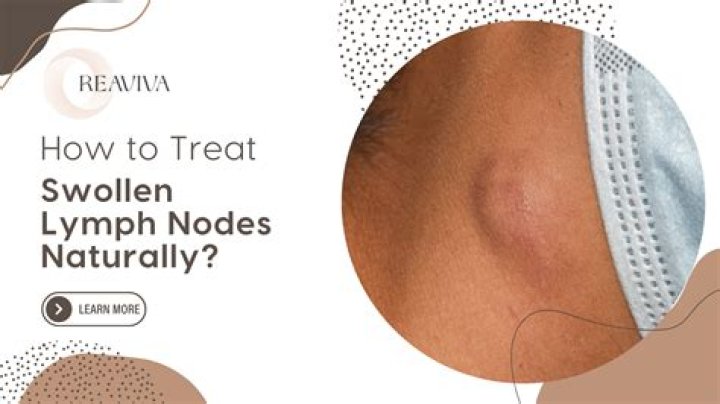 Does massaging a swollen lymph node help?