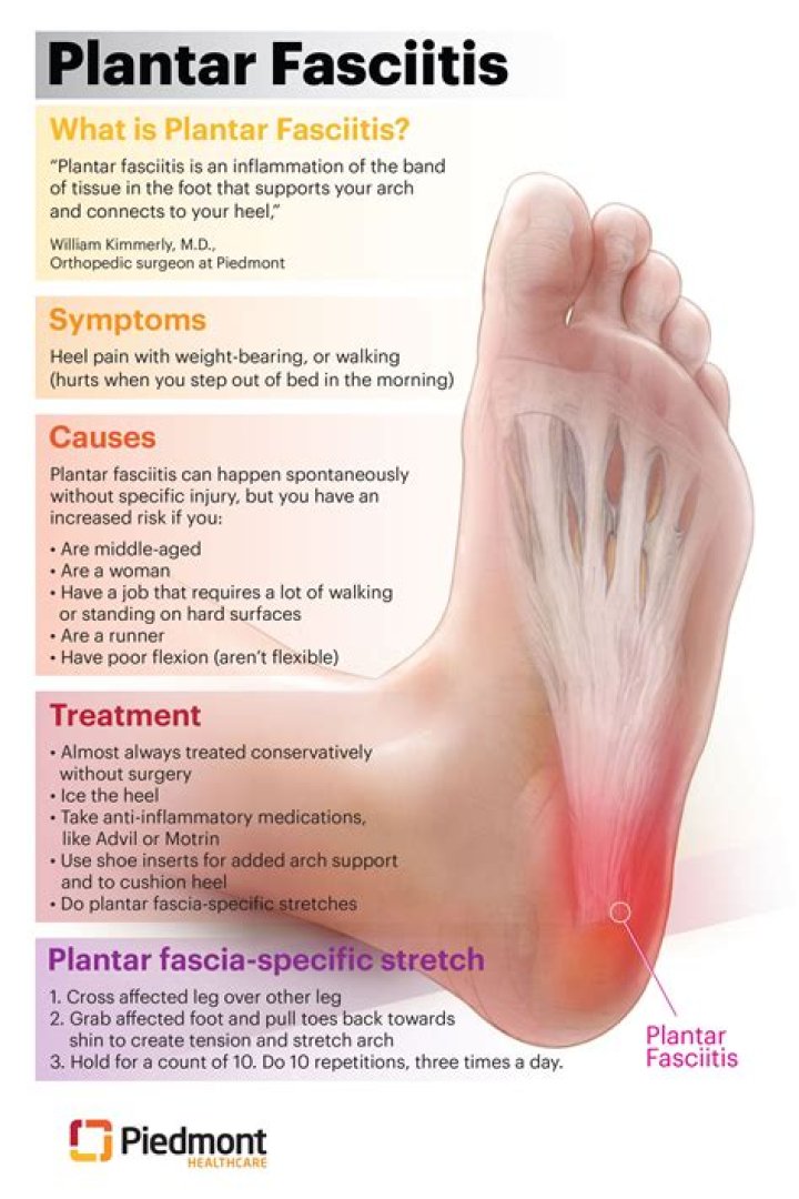 Does plantar fasciitis hurt in Arch?