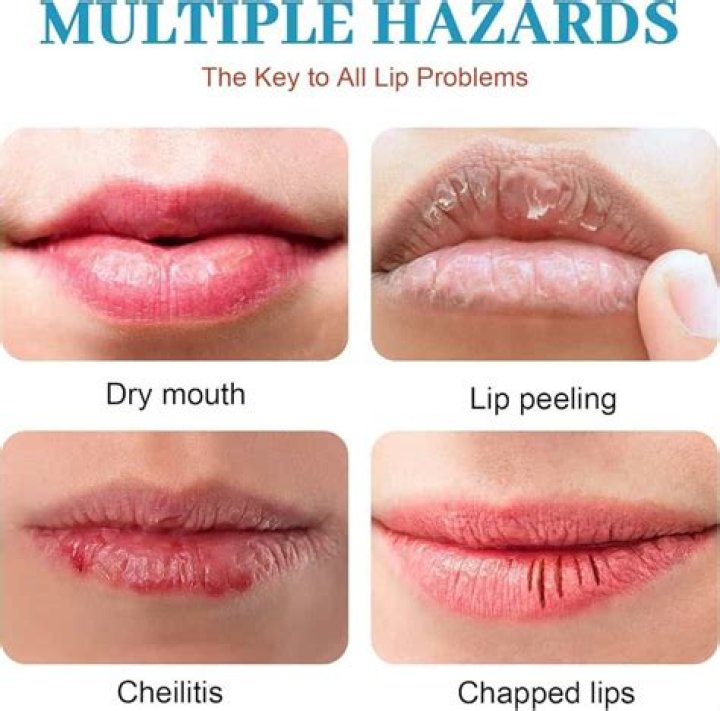 Does putting water on your lips dry them out?