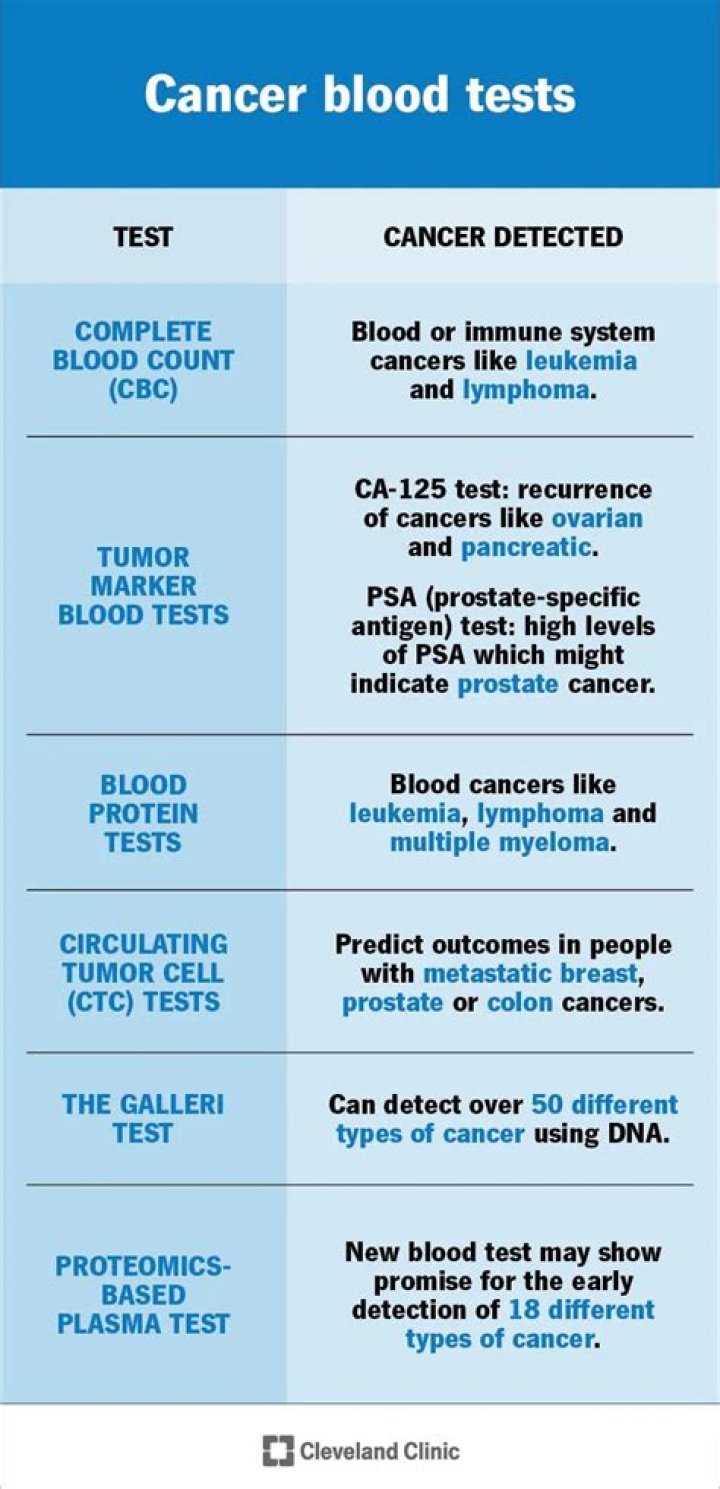 Does Sjogren's always show up in blood test?
