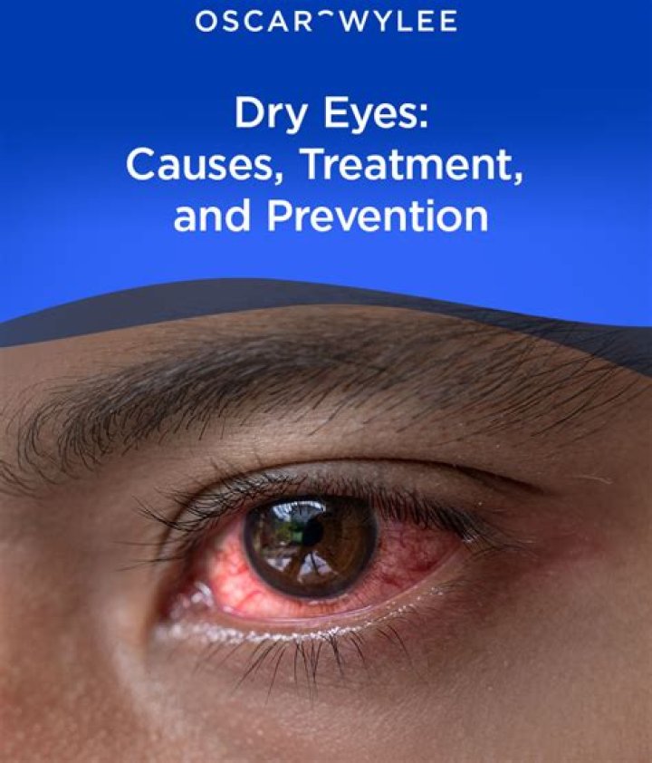 Does SMILE cause dry eyes?