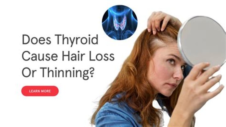 Does thyroid cause hair loss?