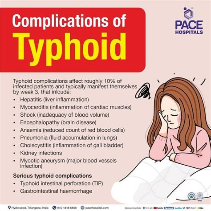 Does typhoid affect the eyes?