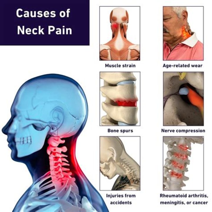 Does typhoid cause neck pain?