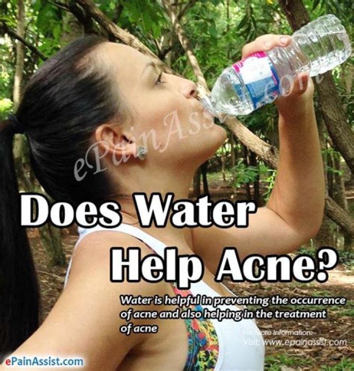Does water help acne?
