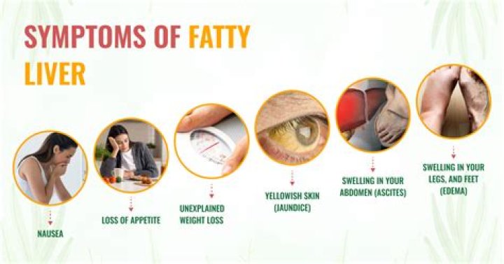 Does your liver affect your poop?