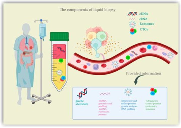 How accurate are lung biopsies?