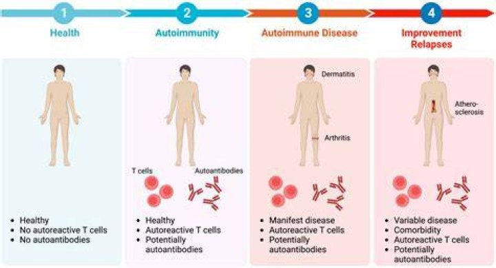 How can I calm my autoimmune disease?