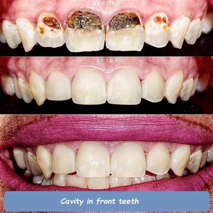 How can I get my teeth fixed for free UK?