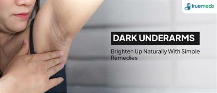 How can I get rid of dark underarms?