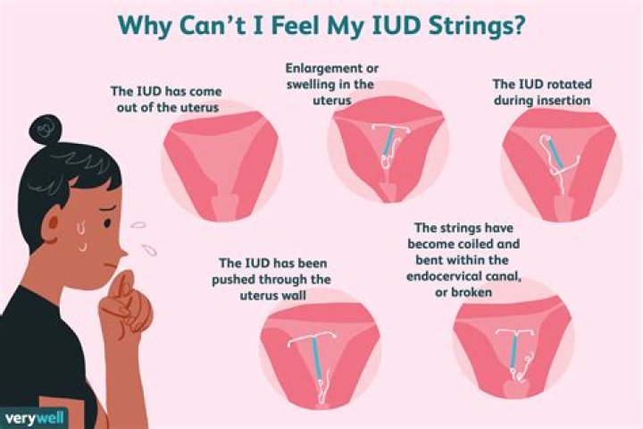 How can I make my IUD less painful?