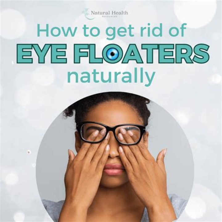 How can I naturally get rid of eye floaters?