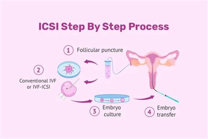 How can I prepare for ICSI treatment?
