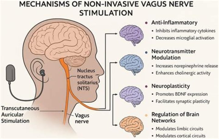 How can I stimulate my brain for ADHD?