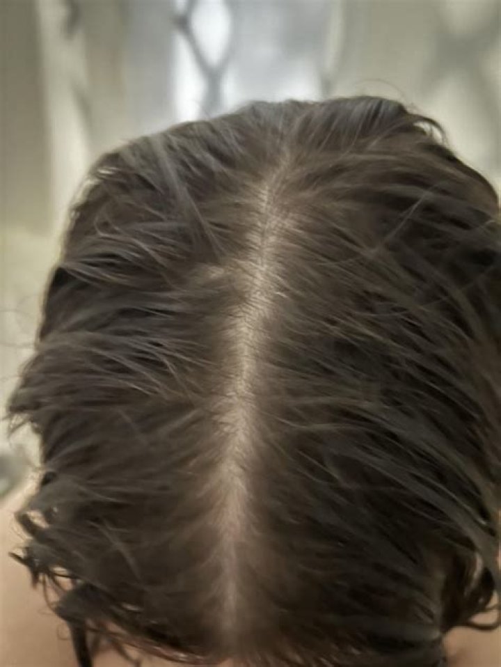 How can I tell if my hair is thinning?