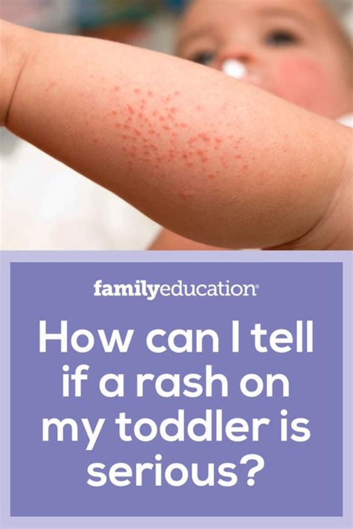 How can I tell if my toddler has eye problems?