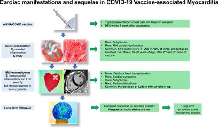 How common is myocarditis in young men during the COVID-19 pandemic?