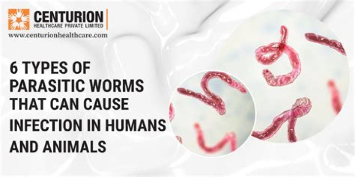 How contagious are roundworms?