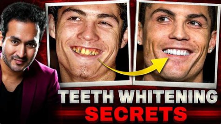 How do actors get such white teeth?
