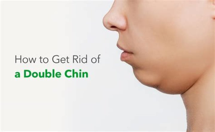 How do I get rid of my double chins?
