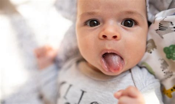 How do I know my baby has colics?