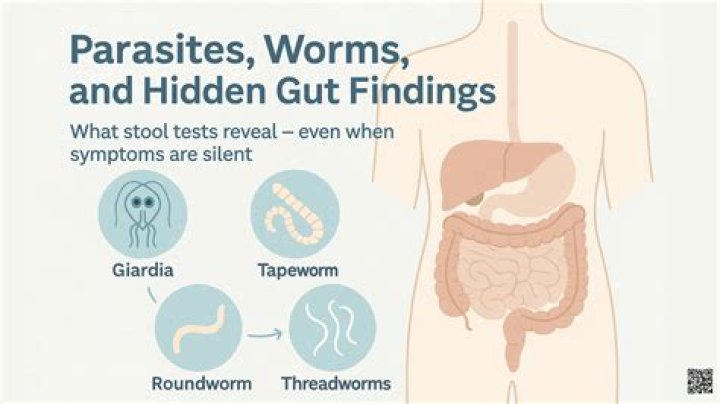How do I know of I have worms?