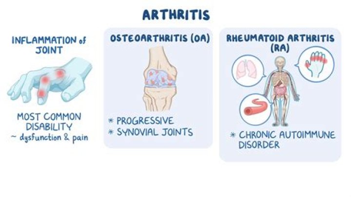 How do I know what type of arthritis I have?