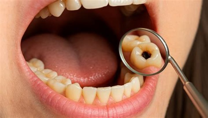 How do u get rid of cavity breath?