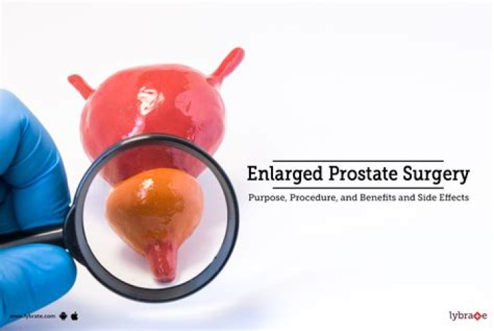 How do urologists treat enlarged prostate?
