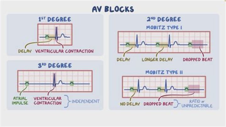 How do you block an ultrasound?