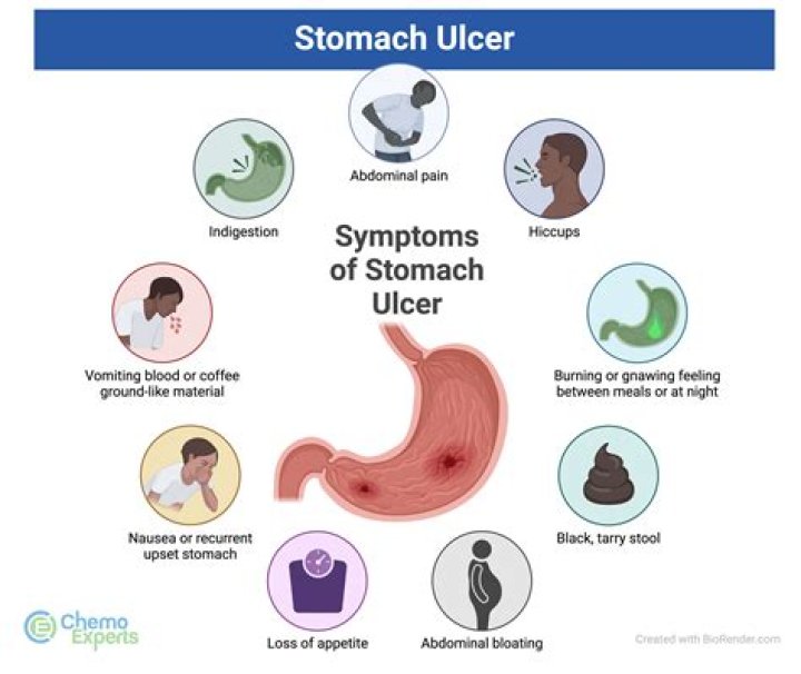 How do you detect a stomach ulcer?