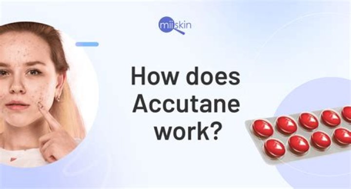 How do you get on Accutane?